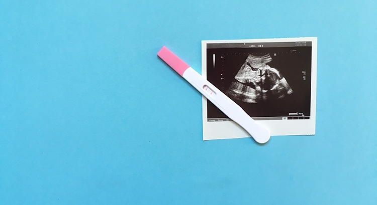 «Устроилась, а через полгода объявила о беременности»: что делать работодателю?